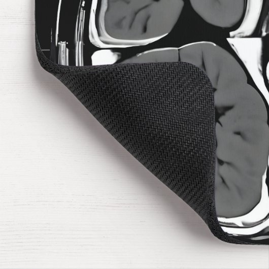 MRT-Gehirnuntersuchung Mousepad (Ecke)