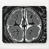 MRT-Gehirnuntersuchung Mousepad (Vorne)