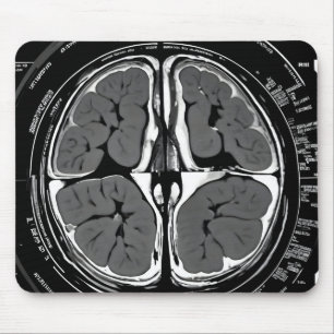 MRT-Gehirnuntersuchung Mousepad