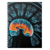 MRT-Gehirnuntersuchung Notizblock (Vorderseite)