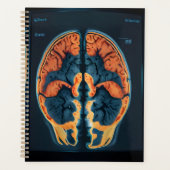 MRT-Gehirnuntersuchung Planer (Vorderseite)