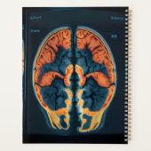 MRT-Gehirnuntersuchung Planer (Rückseite)