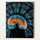 MRT-Gehirnuntersuchung Planer (Rückseite)