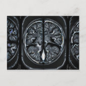 MRT-Gehirnuntersuchung Postkarte (Vorderseite)