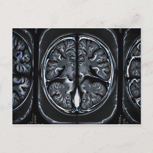 MRT-Gehirnuntersuchung Postkarte (Vorderseite)