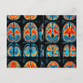 MRT-Gehirnuntersuchung Postkarte (Vorderseite)