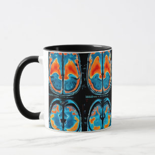 MRT-Gehirnuntersuchung Tasse