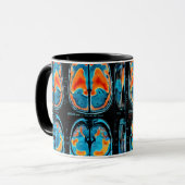 MRT-Gehirnuntersuchung Tasse (Vorderseite Links)