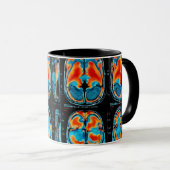 MRT-Gehirnuntersuchung Tasse (VorderseiteRechts)