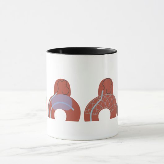 Mug Aneurismas Von Tasse (Zentrum)