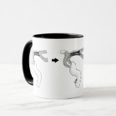 Mug Trombectomía Von Tasse (Vorderseite Links)