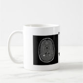 Multiple Sklerose Kaffeetasse (Links)