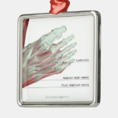 Musculoskeleton des Fußes Ornament Aus Metall (Links)