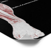 Muskelanatomie Poster (Ecke)