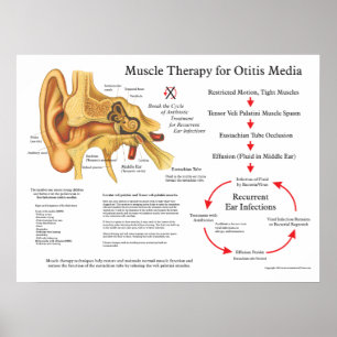 Muskelmassage Therapie für Otitis Media Poster