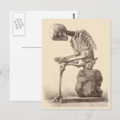 My Feet Are Killing Postkarte (Vorne/Hinten)