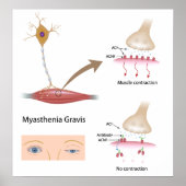 Myasthenie Gravis eye Poster (Vorne)