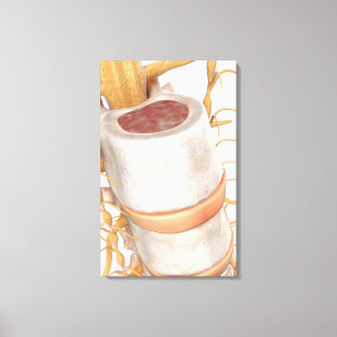 Nah oben von einem invertebral Disc im Dorn Leinwanddruck