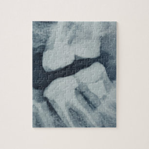 Nahaufnahme eines zahnmedizinischen Röntgenstrahl Puzzle