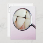 Nahe der Zähne, die im Zahnspiegel reflektiert wer Postkarte (Vorne/Hinten)
