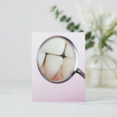 Nahe der Zähne, die im Zahnspiegel reflektiert wer Postkarte (Stehend Vorderseite)