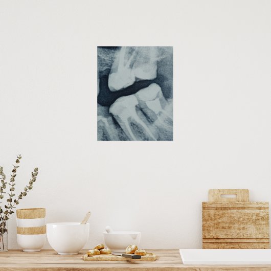 Nahe einer Röntgenröhre Poster (Küche)