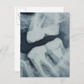 Nahe einer Röntgenröhre Postkarte (Vorne/Hinten)