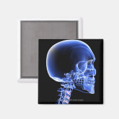 Nahe Röntgenaufnahme der Knochen im Nacken Magnet (Vorderseite/Rückseite)