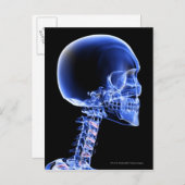 Nahe Röntgenaufnahme der Knochen im Nacken Postkarte (Vorne/Hinten)