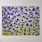 Nahes Anhäufen von Froschspflanzeiern bald Kaulqua Poster (Vorne)