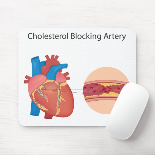 Narkose Blutgefäße Mousepad (Mit Mouse)