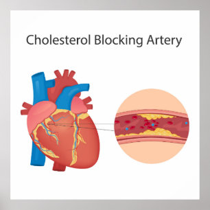 Narkose Blutgefäße Poster
