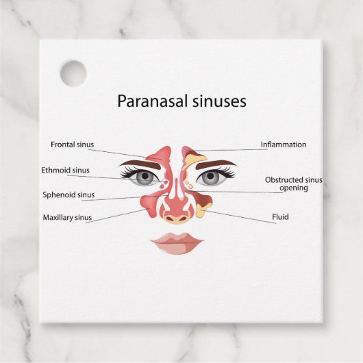 Nasennebenhöhlen Geschenkanhänger (Vorderseite)