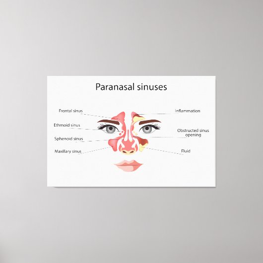 Nasennebenhöhlen Leinwanddruck (Vorderseite)
