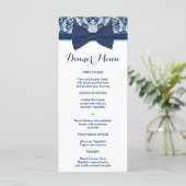 Navy Blue & White Lace Bow Slim Dinner Menu Menükarte (Stehend Vorderseite)