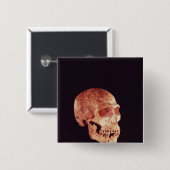 Neanderthal-Schädel, entdeckt auf Mt Carmel Button (Vorne & Hinten)