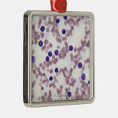 Neoplastische Lymphozyte-Zellen Silbernes Ornament (Rechts)