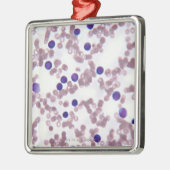 Neoplastische Lymphozyte-Zellen Silbernes Ornament (Links)