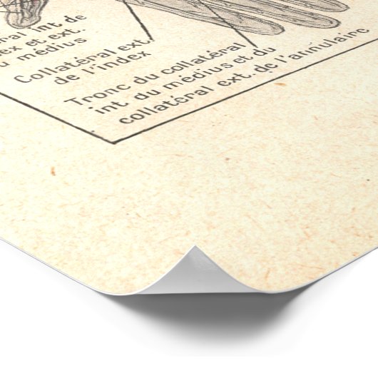 Nerves of the Arms Anatomy Poster in Französisch (Ecke)