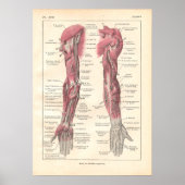 Nerves of the Arms Anatomy Poster in Französisch (Vorne)