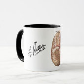 Netter Basal View of Brain - Tasse (Vorderseite Links)