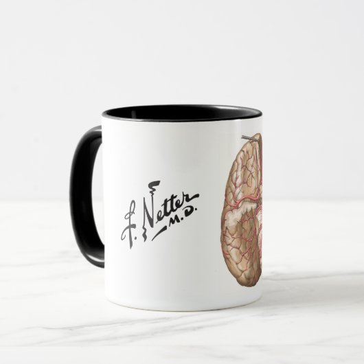 Netter Basal View of Brain - Tasse (Vorderseite Links)