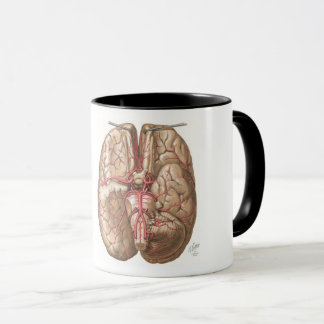 Netter Basal View of Brain - Tasse