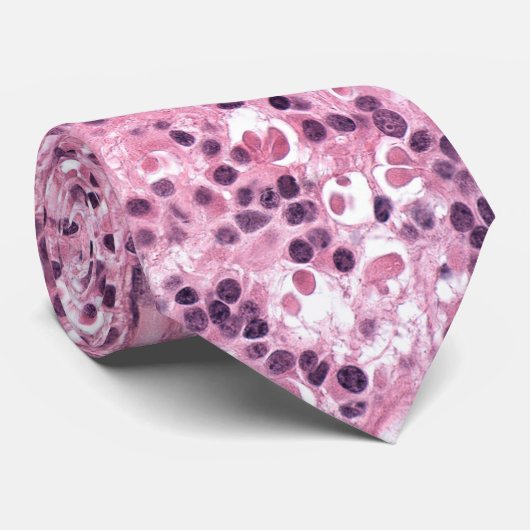 Netzhauttumor Krawatte (Gerollt)