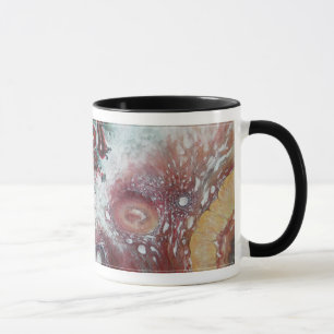 Neu! Kundengerechter "bösartiger Struma Ovarii " Tasse