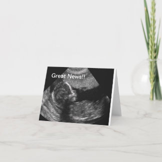 Neuer Baby-Ultraschall Ankündigung