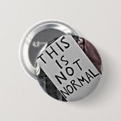 Nicht normal button (Vorne & Hinten)