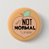 Nicht normaler Orange-Druckknopf Button (Vorderseite)