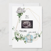 Niedliche Twins Ultrasound dank Baby Viewpoint Dankeskarte (Vorderseite)