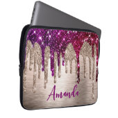 Niedlicher, moderner rosafarbener Glitzer Tropfen  Laptopschutzhülle (Vorne Rechts)